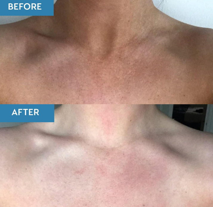 He-Shi Tan Remover & Primer, Award Winning Fake Tan Eraser - 5 Minute Fake Tan